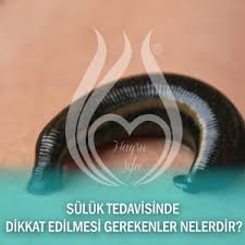 Suluk Tedavisinde Dikkat Edilmesi Gerekenler Nelerdir