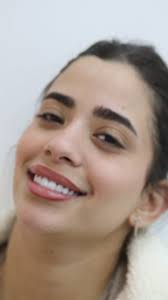 The Best or Nothing 🥇, Dr.Alaa Rashed, #new #smile #desgin #explore #more  #dentalclinic #naturallook #veneers #teeth #art