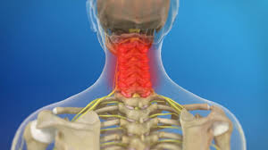 Despite being a relatively small region, it contains a range of important anatomical features. Tips For Weekend Warriors Preventing Back And Neck Injuries Baldwin Bone Joint Pc