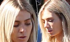 Nadia bartel is one of the richest australian blogger. Nadia Bartel Steps Out For A Doctors Appointment After She Underwent Surgery On Her Nose Daily Mail Online