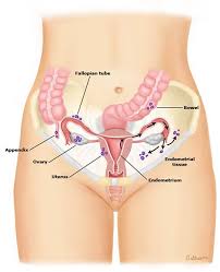 Evidence suggests that our evolutionary ancestors used their appendixes to digest tough food like tree bark, but we don't use ours in digestion now. Mri For Endometriosis Cedars Sinai