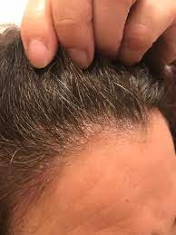 To restore moisture to your skin and hair, supplement your diet with black currant oil or evening primrose oil. 37 Things To Help Your Body Recover From Winter Dryness