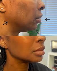 Gray Aesthetics, 50 Scott Adam Rd, Ste 207, Cockeysville, MD 21030, US