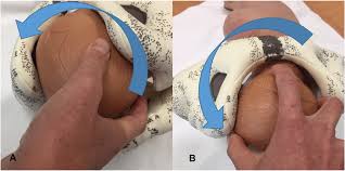 Image result for Manual Rotation in Occipitoposterior Presentation