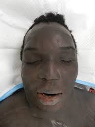 The suspect, Justin Rene Lewis of Decatur, was found in Forest Park and  arrested Wednesday night, online jail records show.