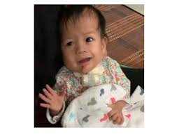 Bayi istimewa, ainul mardhiah ahmad safiuddin, terus menunjukkan perkembangan positif selepas pembedahan membuang tumor seberat 200 gram di bahagian mulutnya, 10 jun lalu. Little Ainul Is All Smiles In Video The Star