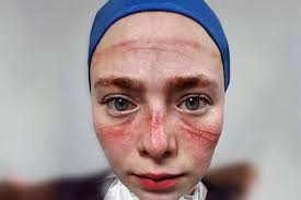 Sağlık çalışanlarının yüzde 52'si geçinemiyor, sendikalar ücretlerde adalet  istiyor