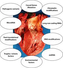 Hypertrophic Cardiomyopathy | Circulation Research