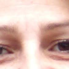 Adrian Yi, MD, Board Certified Facial Plastic Surgeon