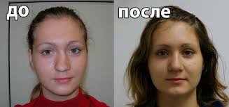 клиника ринопластики
