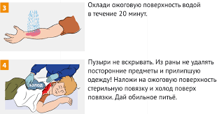 Termicheskij Ozhog Pervaya Pomosh Lechenie Priznaki Stepeni Mchs Rossii