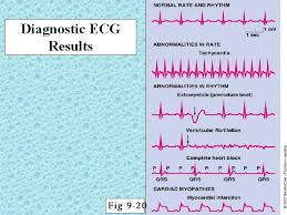 Kita menggunakan strategi akses berintegrasi yang mana kita membina ekosistem. Pertama Kali Buat Ecg Dan Bacaan Jantung Terbalik Ana Suhana
