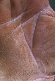 Image result for Thesium nigricans