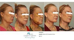 El paso cosmetic surgery is pleased to announce our new outpatient plastic surgery center in west texas. Facebook