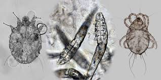 Image result for Demodex brevis