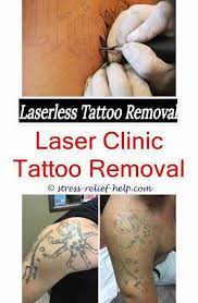 How Much Would It Cost To Get A Tattoo Removed Red Tattoo Laser Removal How To Get A Tattoo Removed Tat Tattoo Removal Cost Laser Tattoo Laser Tattoo Removal