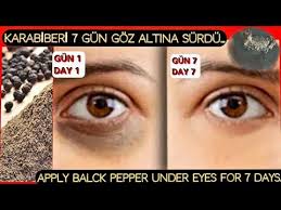 7 Gun Bitiyor Karabiberle Goz Alti Morluklari Kirisiklik Sona Eriyor Ciltbakimi Youtube Gozler Cilt Bakimi Makyaj