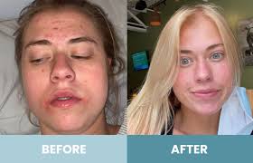 Dark Spots & Sun Damage