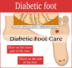 Image result for toe black diabetes