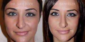 Sam Rizk, MD Reviews, Before and After Photos, Answers