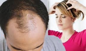 What did you like about this page? Hair Loss Treatment The Cheapest Method To Stimulate Hair Growth And Avoid Alopecia Sound Health And Lasting Wealth