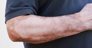 However, for most people, itching is the main symptom of a. Skin Conditions That Can Be A Sign Of Diabetes Dispatchhealth