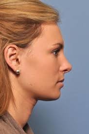 Anatomy of the Facial Profile