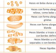 SEMERGEN | Síndrome del intestino irritable - Dra. Sales