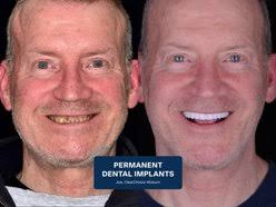 TOP 10 BEST Prosthetics near Downingtown, PA