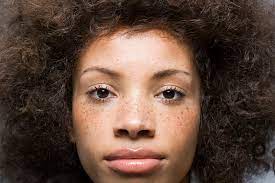 We did not find results for: When You Should Worry About Freckles According To Dermatologists