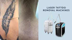Of course, you will also have the advantage of actually owning the machinery. Learn More About Our Laser Tattoo Removal Machines Youtube