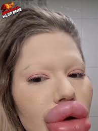 AbnormalHumans Credits:@loana.squirty