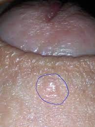 We did not find results for: Heb Ik Syfilis Medische Forum Dokter Nl