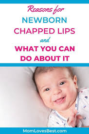 Newborn Chapped Lips Treatments 7 Reasons Why Mom Loves Best In 2020 Newborn Newborn Care Honest Baby Products