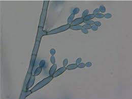 Fonsecaea is a genus of fungi in the family herpotrichiellaceae. Microscopic Appearance Of Fonsecaea Monophora Cbs 123849 Download Scientific Diagram