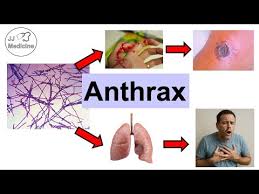 Image result for Anthrax
