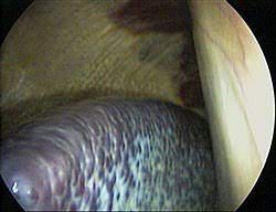 The spleen performs the valuable function of filtering blood of pathogens and diseased cells. Ø·Ø­Ø§Ù„ ÙˆÙŠÙƒÙŠØ¨ÙŠØ¯ÙŠØ§