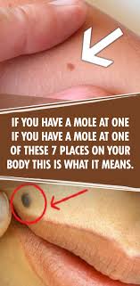 If You Have A Mole At One Of These 7 Places On Your Body This Is What It Means You Will Be Surprised Mole Mole Meaning Body