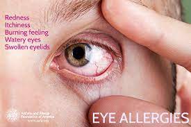 Eye Allergy Allergic Conjunctivitis Aafa Org