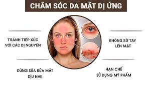 Tìm hiểu các thông tin về dị ứng da mặt
