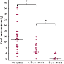 Esophagus And Diaphragmatic Hernia Schwartzs Principles