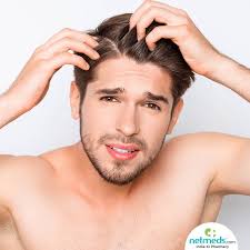 Can itchy scalp cause hair loss? 4 Kinds Of Dandruff Identify Which Type Is Causing Your Scalp To Itch Flake
