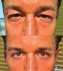 Saroudi Advanced Lasik & Eye Centers