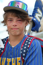 Any possible solutions for a torn thumb?