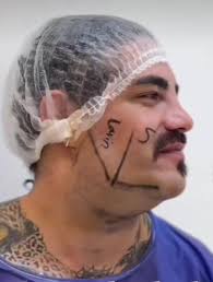 Dr Carlos Limon Cirujano Guadalajara