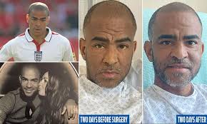 EXCLUSIVE: Ill, thin and broken, ex-England footballer Kieron Dyer, 44, was  dying with a rare liver disease just 11 weeks ago. Now, he speaks for the  first time after a 'miracle' transplant