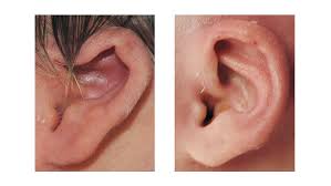 نتیجه جستجوی لغت [constricted] در گوگل