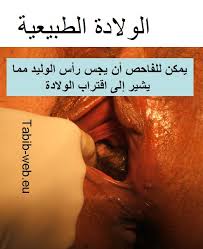 طبيب الوب الولادة الطبيعية بالصور صور الولادة لا ينصح بفتح هذا الموضوع من قبل الأشخاص ذوي المشاعر الحساسة دكتور لؤي خدام
