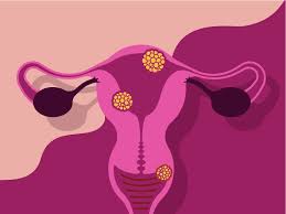 What Is Vaginal Discharge