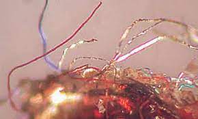 Morgellons disease is a controversial, unexplained skin condition. Morgellons A Hidden Epidemic Or Mass Hysteria Health Wellbeing The Guardian
